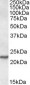 SAR1A / SAR1 Antibody (Internal)